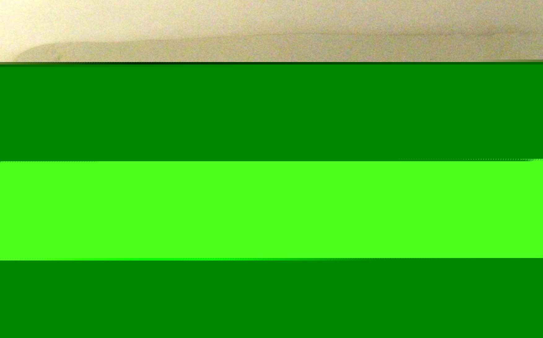 Triathlon X3 Total Stabilizer+ Tibial Insert